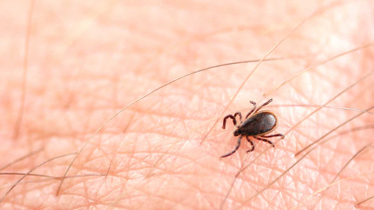 Lyme disease not present in Malta; Raises alarm in Europe Newsbook