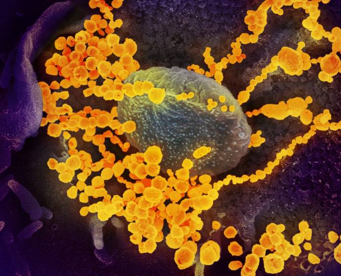 Scanning electron microscope image shows SARS-CoV-2 (round gold objects), also known as novel coronavirus